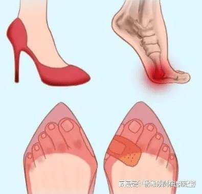 的高筒靴小心背后隐藏的安全隐患！AG旗舰厅网站爱美女孩冬季必备(图1)